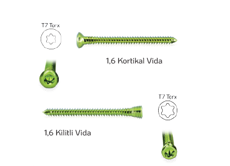 Titanyum Ø 1,6 mm Kilitli Vida - 1 Adet