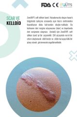 ZoneTAPE Soft Silikon Bant – Profesyonel Yara İzi Bakımı