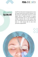 ZoneTAPE Soft Silikon Bant – Profesyonel Yara İzi Bakımı