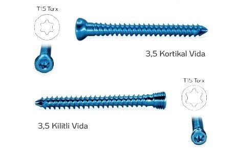 Titanyum Ø3,5 mm Kortikal Vida - 1 Adet